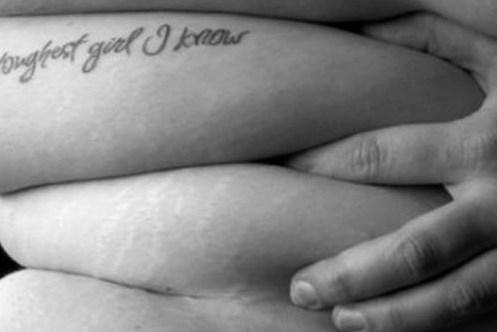 Apología de Aceptación