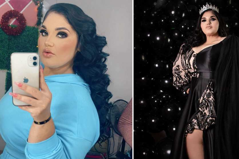 Morir por una operación quirúrgica y mucho más...